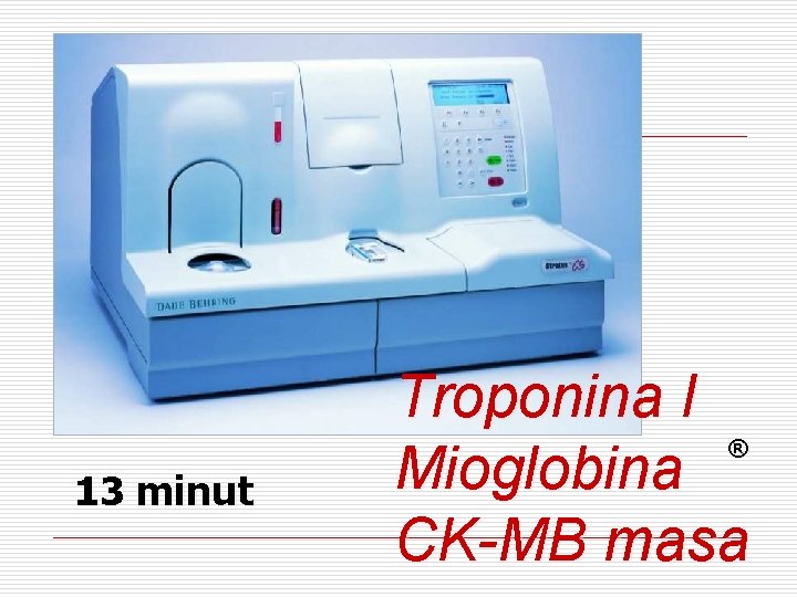 13 minut Troponina I ® Mioglobina CK-MB masa 