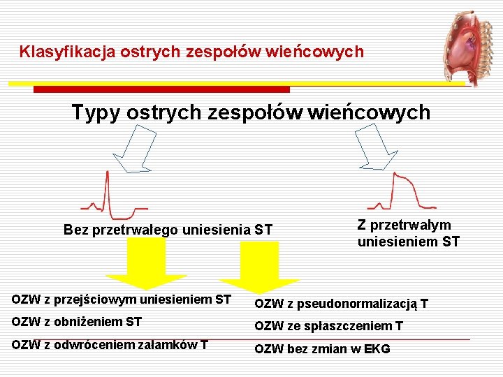 Klasyfikacja ostrych zespołów wieńcowych Typy ostrych zespołów wieńcowych Bez przetrwałego uniesienia ST Z przetrwałym