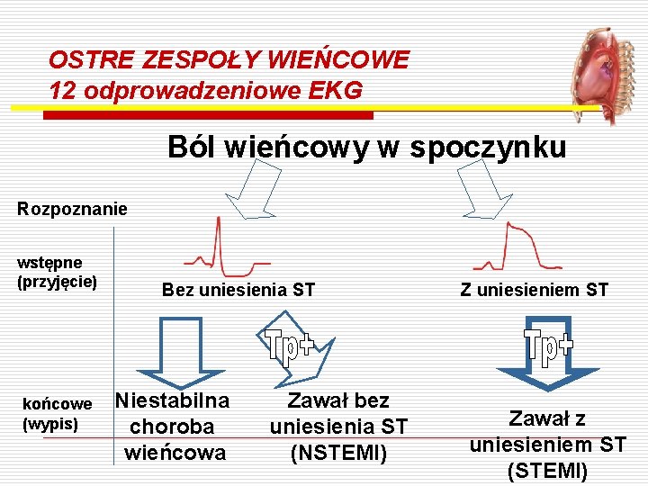 OSTRE ZESPOŁY WIEŃCOWE 12 odprowadzeniowe EKG Ból wieńcowy w spoczynku Rozpoznanie wstępne (przyjęcie) końcowe