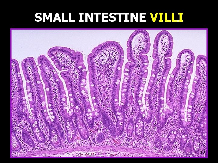 SMALL INTESTINE VILLI 13 SMALL INTESTINE VILLI 13