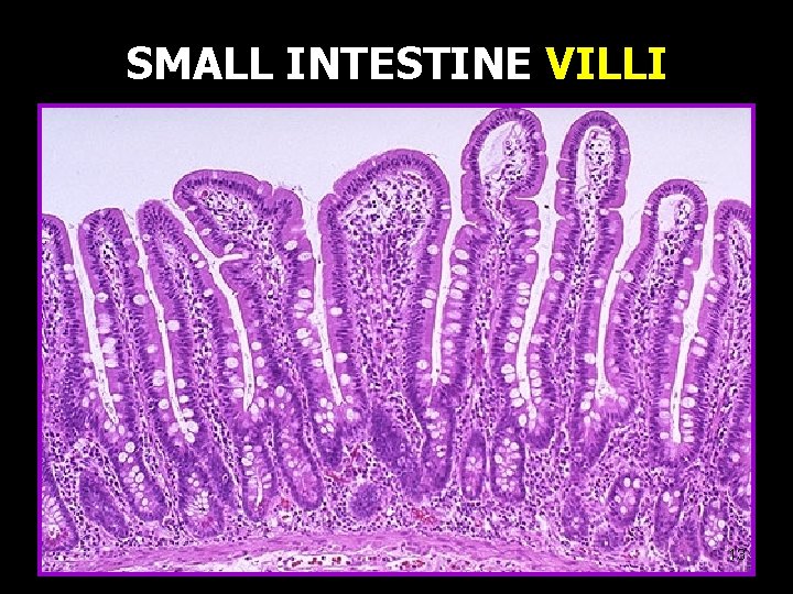 SMALL INTESTINE VILLI 13 