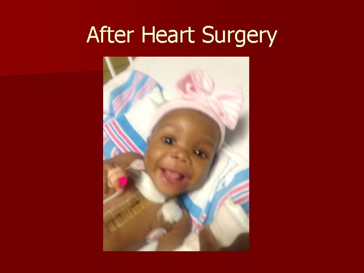 After Heart Surgery 