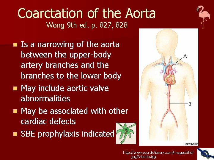 Coarctation of the Aorta Wong 9 th ed. p. 827, 828 n n Is