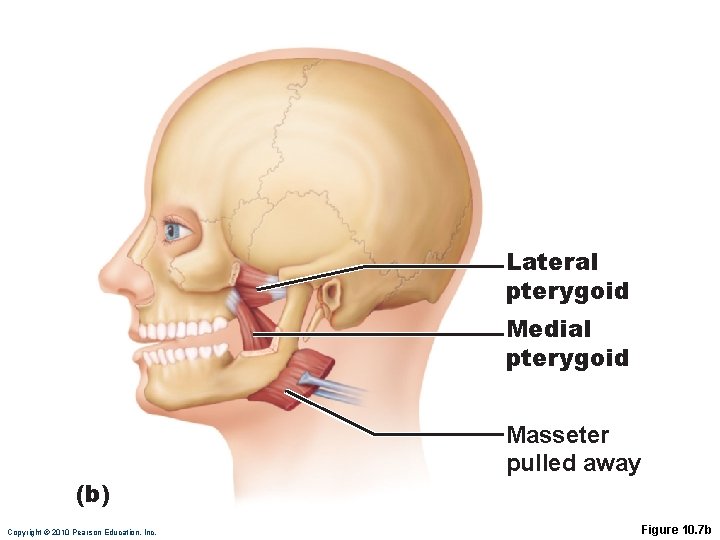 Lateral pterygoid Medial pterygoid (b) Copyright © 2010 Pearson Education, Inc. Masseter pulled away