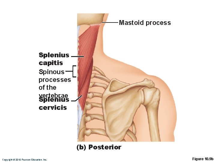 Mastoid process Splenius capitis Spinous processes of the vertebrae Splenius cervicis (b) Posterior Copyright