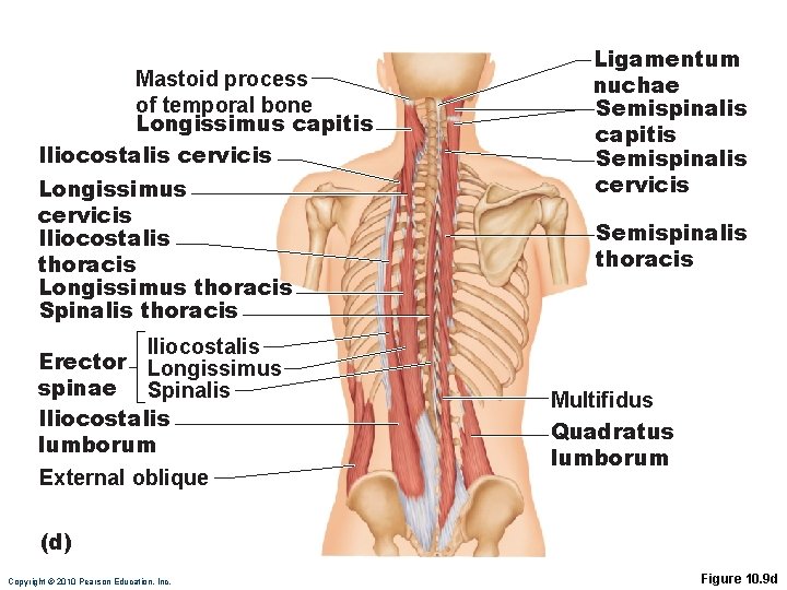 Mastoid process of temporal bone Longissimus capitis Iliocostalis cervicis Longissimus cervicis Iliocostalis thoracis Longissimus