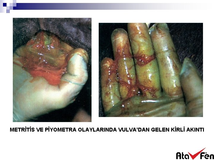 METRİTİS VE PİYOMETRA OLAYLARINDA VULVA’DAN GELEN KİRLİ AKINTI 