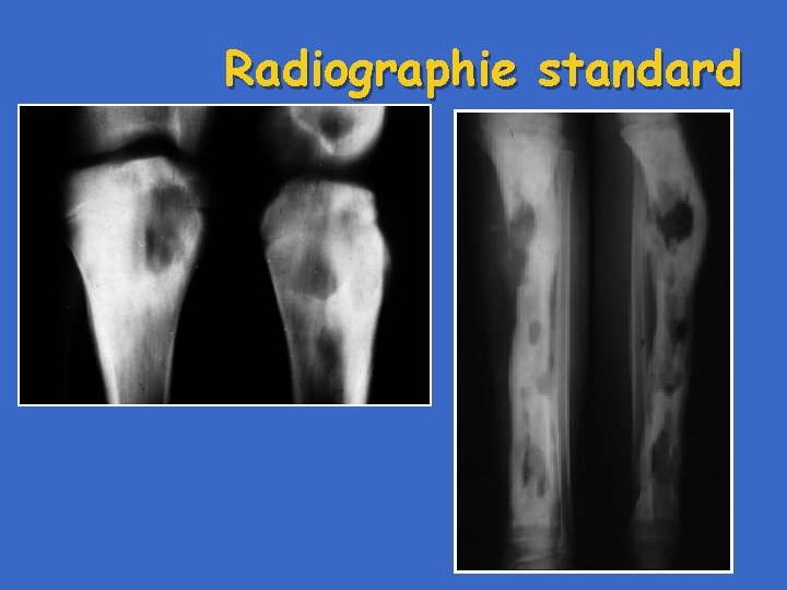 Radiographie standard 