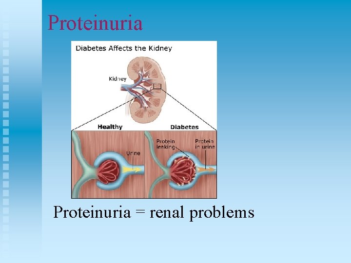 Proteinuria = renal problems 