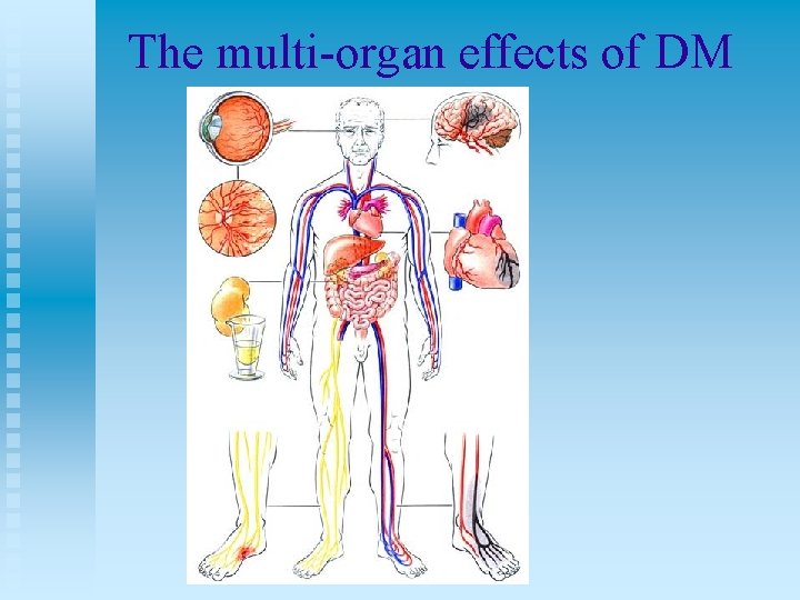 The multi-organ effects of DM 
