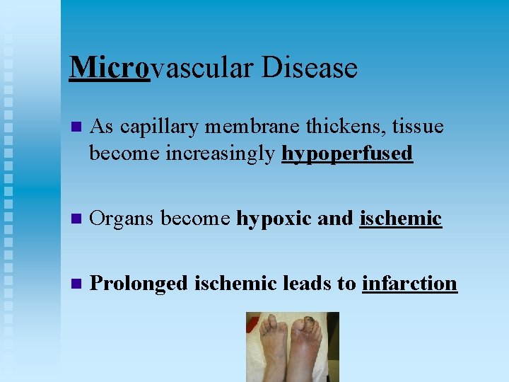 Microvascular Disease n As capillary membrane thickens, tissue become increasingly hypoperfused n Organs become