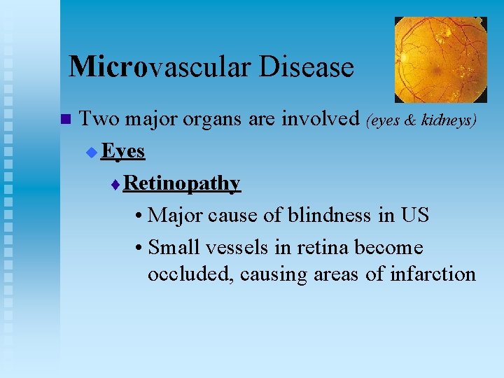 Microvascular Disease n Two major organs are involved (eyes & kidneys) u Eyes t