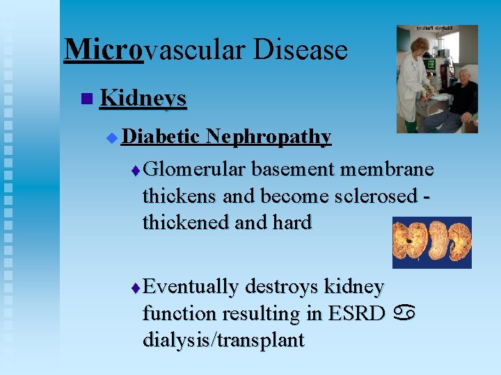 Microvascular Disease n Kidneys u Diabetic Nephropathy t Glomerular basement membrane thickens and become