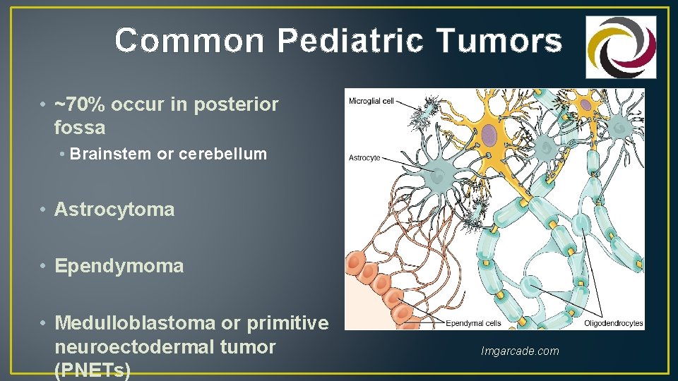 Common Pediatric Tumors • ~70% occur in posterior fossa • Brainstem or cerebellum •