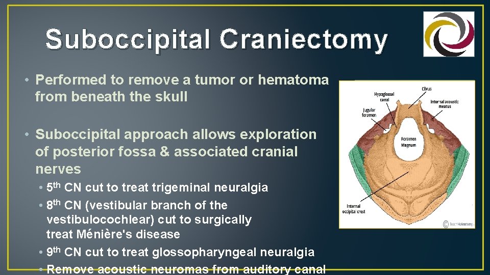 Suboccipital Craniectomy • Performed to remove a tumor or hematoma from beneath the skull