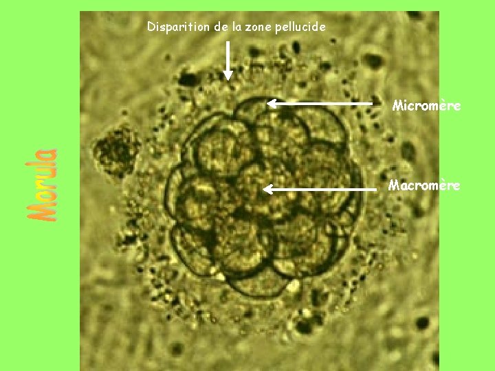 Disparition de la zone pellucide Micromère Macromère 