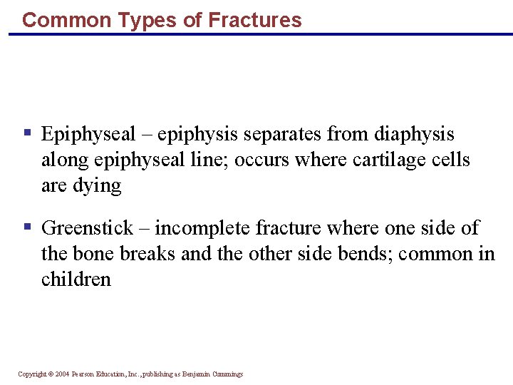 Common Types of Fractures § Epiphyseal – epiphysis separates from diaphysis along epiphyseal line;