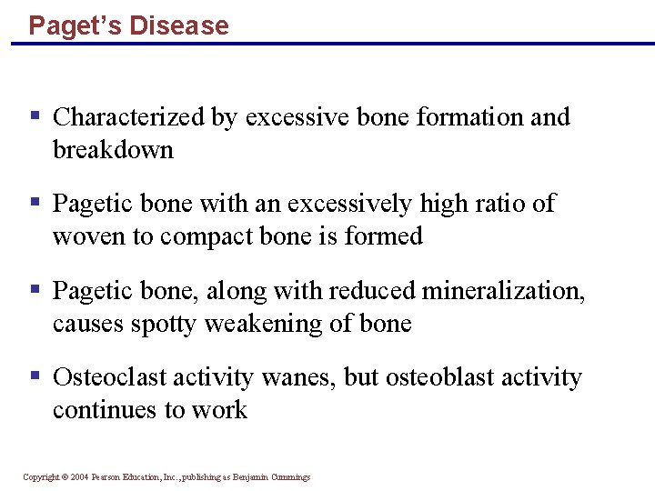 Paget’s Disease § Characterized by excessive bone formation and breakdown § Pagetic bone with