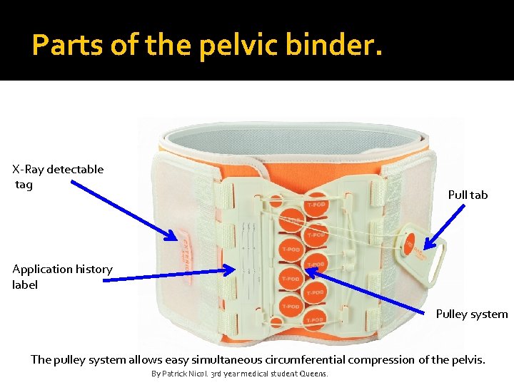 Parts of the pelvic binder. X-Ray detectable tag Pull tab Application history label Pulley