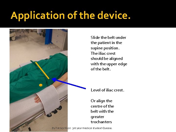 Application of the device. Slide the belt under the patient in the supine position.