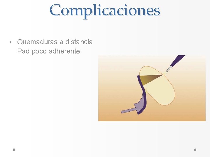 Complicaciones • Quemaduras a distancia Pad poco adherente Complicaciones • Quemaduras a distancia Pad poco adherente