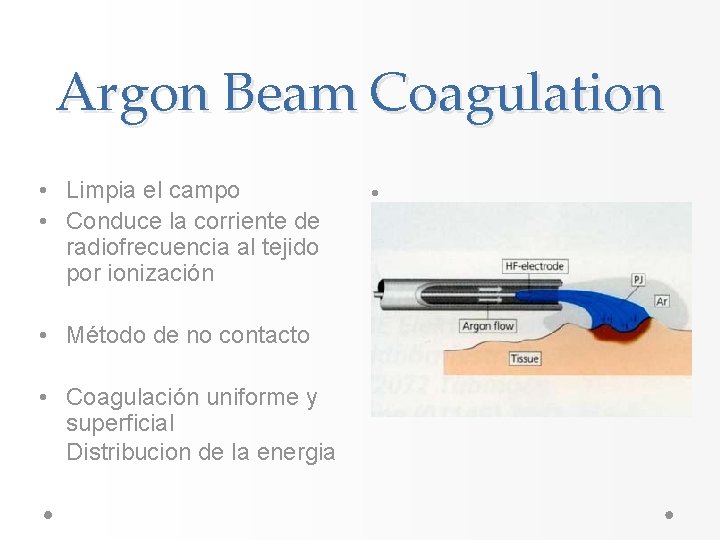 Argon Beam Coagulation • Limpia el campo • Conduce la corriente de radiofrecuencia al Argon Beam Coagulation • Limpia el campo • Conduce la corriente de radiofrecuencia al