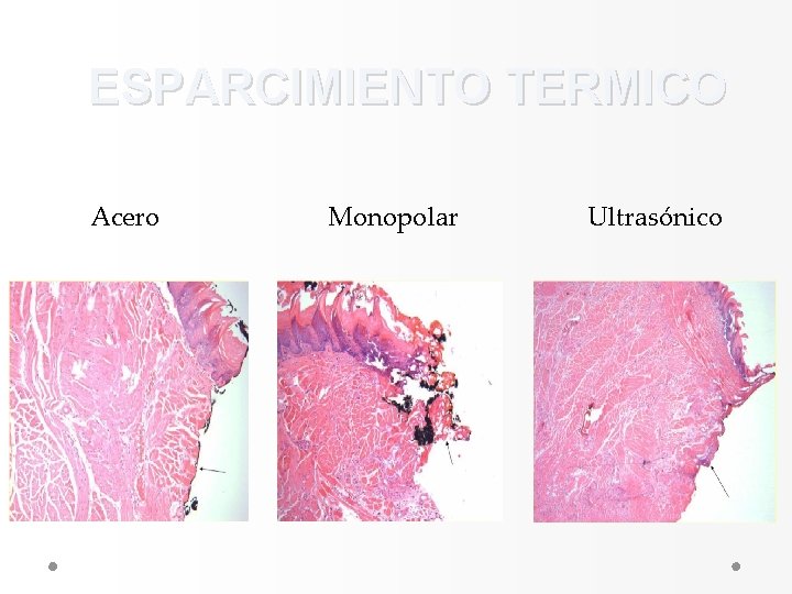 ESPARCIMIENTO TERMICO Acero Monopolar Ultrasónico ESPARCIMIENTO TERMICO Acero Monopolar Ultrasónico