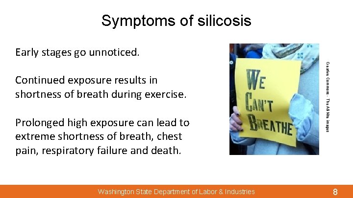 Symptoms of silicosis Early stages go unnoticed. Prolonged high exposure can lead to extreme