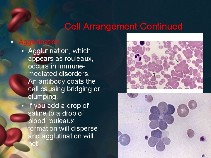 Cell Arrangement Continued • Agglutination, which appears as rouleaux, occurs in immunemediated disorders. An