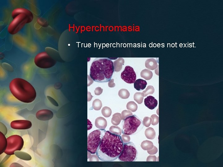 Hyperchromasia • True hyperchromasia does not exist. 