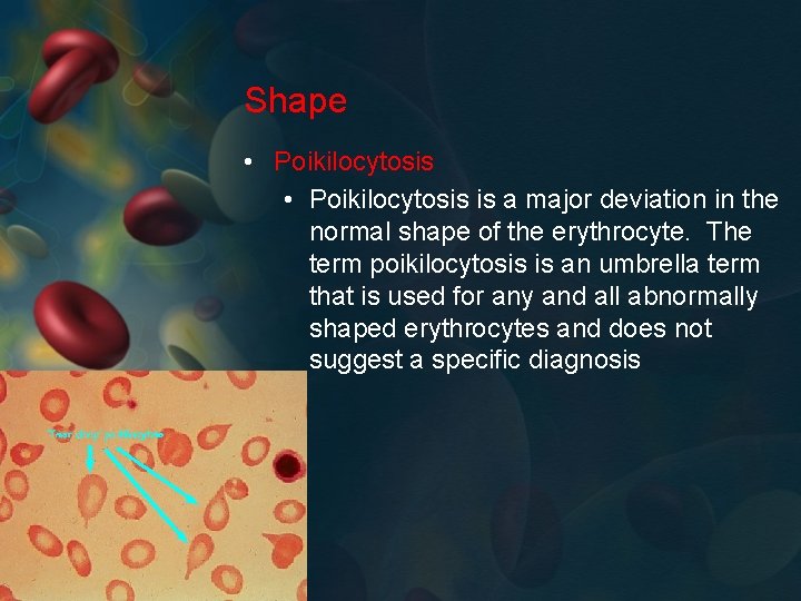 Shape • Poikilocytosis is a major deviation in the normal shape of the erythrocyte.
