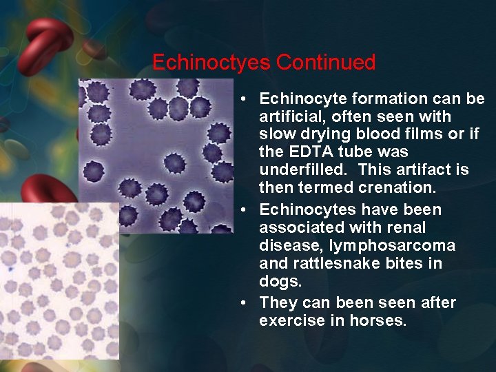 Echinoctyes Continued • Echinocyte formation can be artificial, often seen with slow drying blood