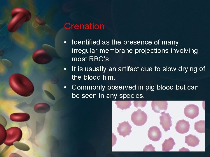 Crenation • Identified as the presence of many irregular membrane projections involving most RBC’s.