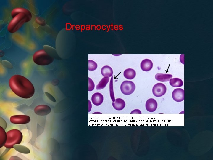 Drepanocytes 