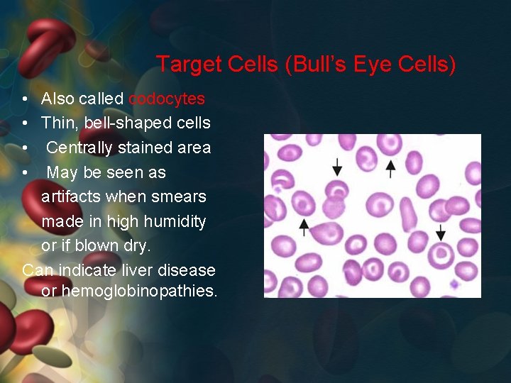 Target Cells (Bull’s Eye Cells) • Also called codocytes • Thin, bell-shaped cells •
