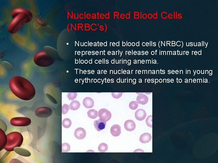 Nucleated Red Blood Cells (NRBC’s) • Nucleated red blood cells (NRBC) usually represent early