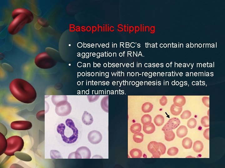 Basophilic Stippling • Observed in RBC’s that contain abnormal aggregation of RNA. • Can