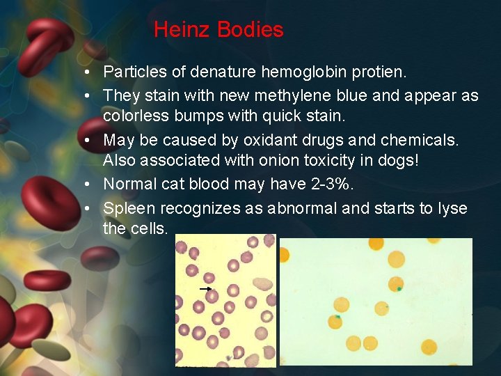 Heinz Bodies • Particles of denature hemoglobin protien. • They stain with new methylene