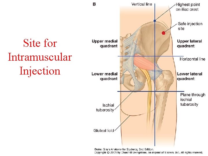 Site for Intramuscular Injection 