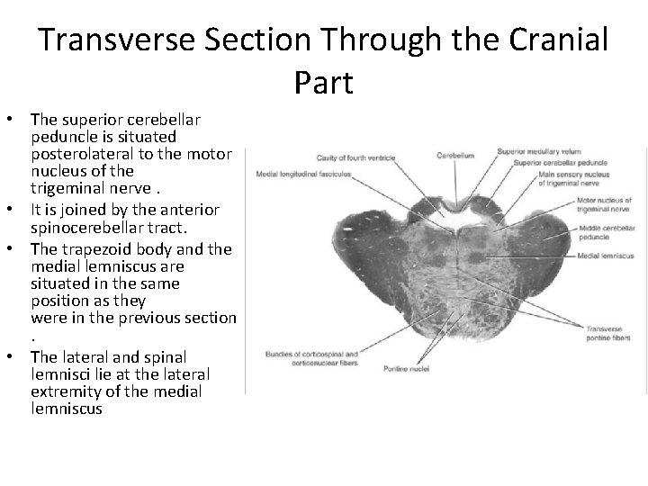 Transverse Section Through the Cranial Part • The superior cerebellar peduncle is situated posterolateral