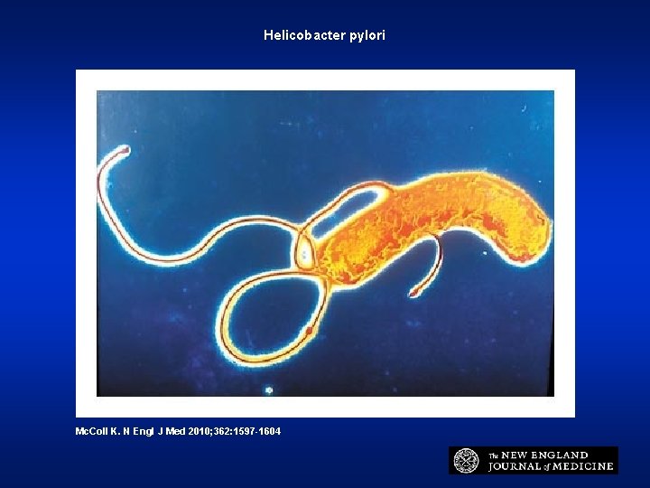 Helicobacter pylori Mc. Coll K. N Engl J Med 2010; 362: 1597 -1604 