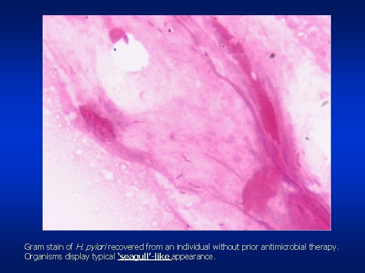 Gram stain of H. pylori recovered from an individual without prior antimicrobial therapy. Organisms