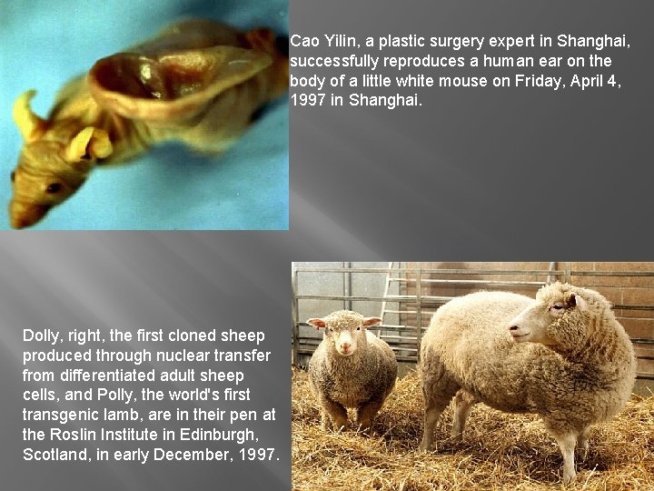 Cao Yilin, a plastic surgery expert in Shanghai, successfully reproduces a human ear on