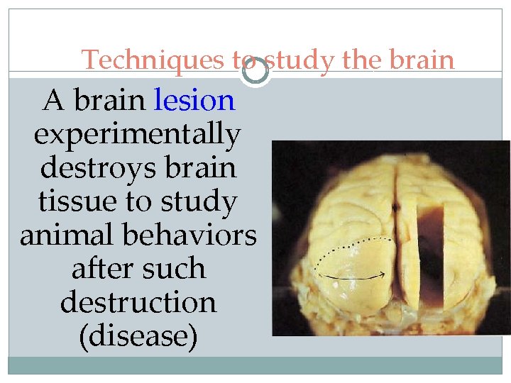 Techniques to study the brain A brain lesion experimentally destroys brain tissue to study