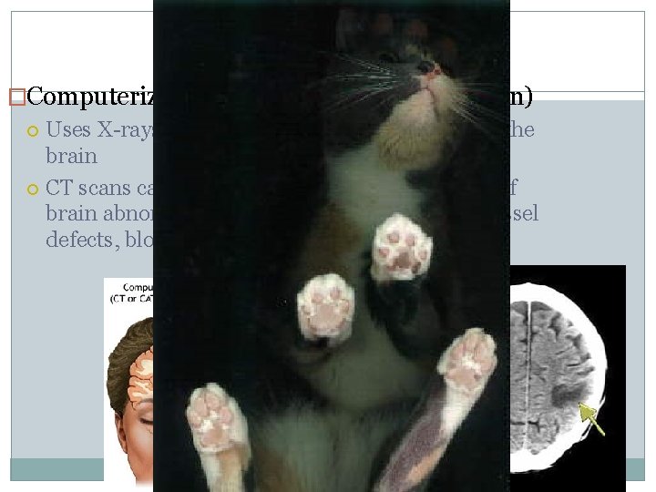 Structural Imaging �Computerized Axial Tomography (CAT-scan) Uses X-rays to create a 3 -dimensional image