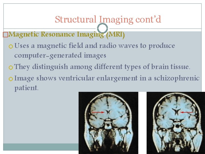 Structural Imaging cont’d �Magnetic Resonance Imaging (MRI) Uses a magnetic field and radio waves