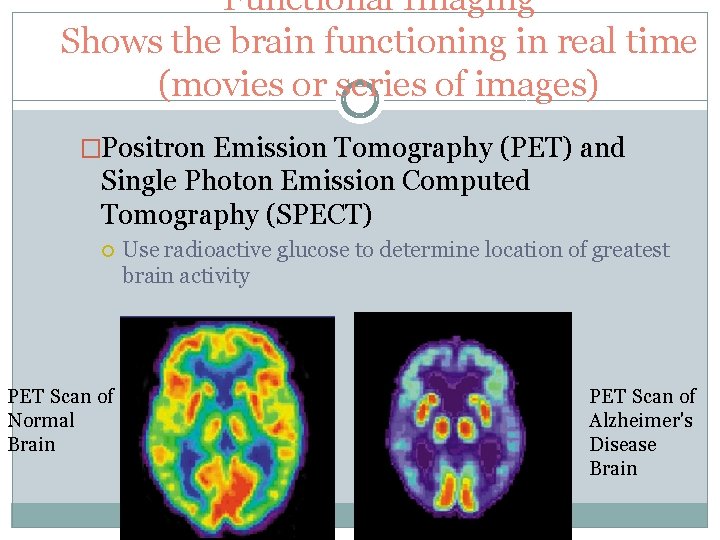 Functional Imaging Shows the brain functioning in real time (movies or series of images)