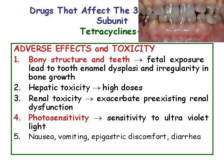 Drugs That Affect The 30 S Ribosomal Subunit Tetracyclines-3 ADVERSE EFFECTS and TOXICITY 1.