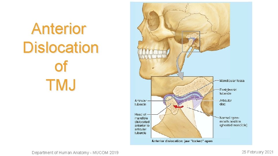 12 Anterior Dislocation of TMJ Department of Human Anatomy - MUCOM 2019 25 February