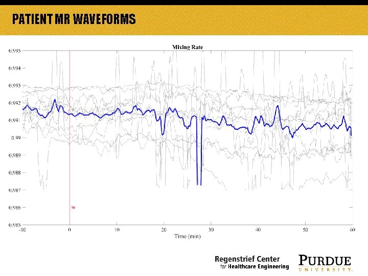 PATIENT MR WAVEFORMS PATIENT MR WAVEFORMS